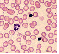 thalassemia map